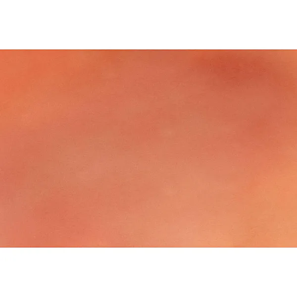 Wound Moulage "1st Degree Burn" – Προσομοίωση Εγκαύματος 1ου Βαθμού Wound Moulage "1st Degree Burn" – Προσομοίωση Εγκαύματος 1ου Βαθμού