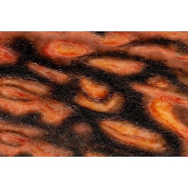 Wound Moulage "3rd Degree Burn" – Προσομοίωση Εγκαύματος 3ου Βαθμού 2 Wound Moulage "3rd Degree Burn" – Προσομοίωση Εγκαύματος 3ου Βαθμού 2