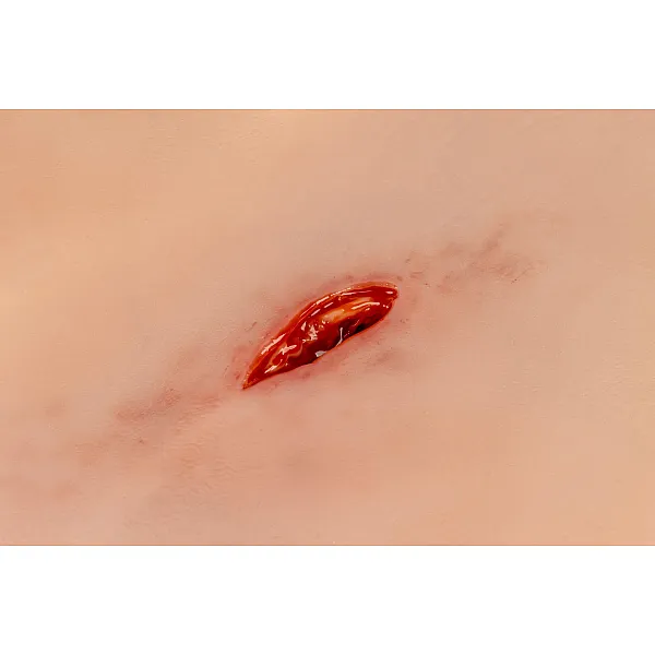 Wound Moulage "Stab Wound with Bleeding Function" – Προσομοίωση Τραύματος από Μαχαίρι με Λειτουργία Αιμορραγίας Wound Moulage "Stab Wound with Bleeding Function" – Προσομοίωση Τραύματος από Μαχαίρι με Λειτουργία Αιμορραγίας