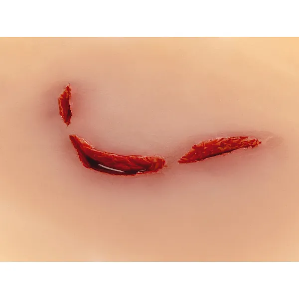 Wound Moulage "Cut Broken Bottle" – Προσομοίωση Κοπής από Σπασμένο Μπουκάλι Wound Moulage "Cut Broken Bottle" – Προσομοίωση Κοπής από Σπασμένο Μπουκάλι
