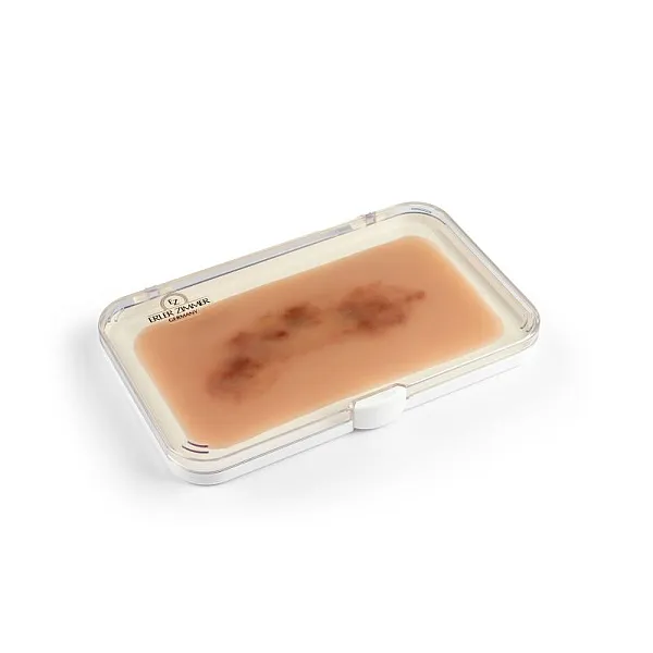 Wound Moulage "Fresh Hematoma" – Προσομοίωση Φρέσκου Αιματώματος Wound Moulage "Fresh Hematoma" – Προσομοίωση Φρέσκου Αιματώματος
