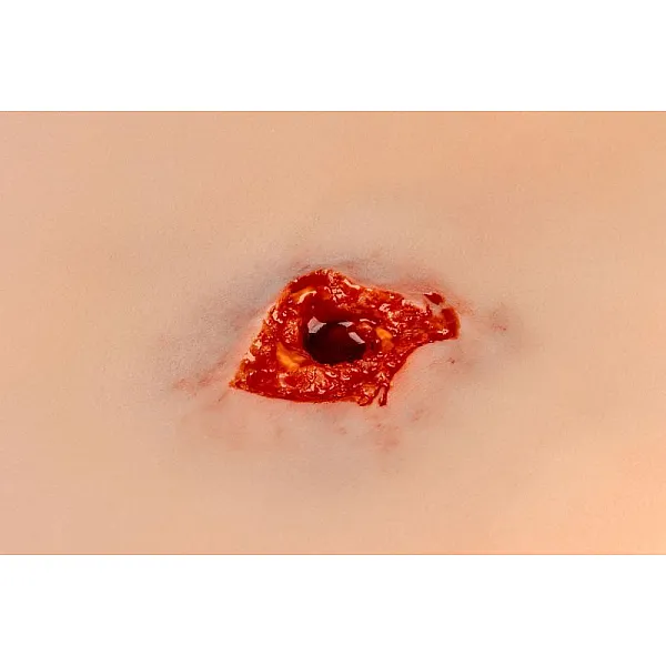 Wound Moulage – Τραύμα από Σφαίρα στο Πόδι με Λειτουργία Αιμορραγίας