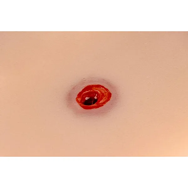Wound Moulage – Τραύμα από Σφαίρα στο Χέρι με Λειτουργία Αιμορραγίας Wound Moulage – Τραύμα από Σφαίρα στο Χέρι με Λειτουργία Αιμορραγίας