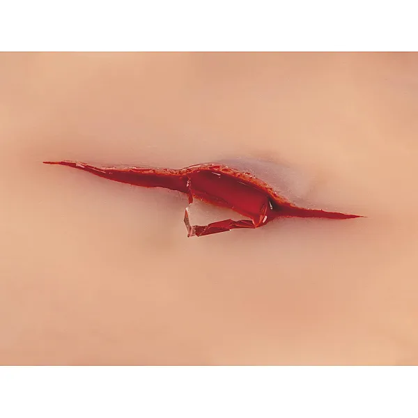Wound Moulage "Cut with Glass Fragment" – Προσομοίωση Κοπής με Θραύσμα Γυαλιού Wound Moulage "Cut with Glass Fragment" – Προσομοίωση Κοπής με Θραύσμα Γυαλιού