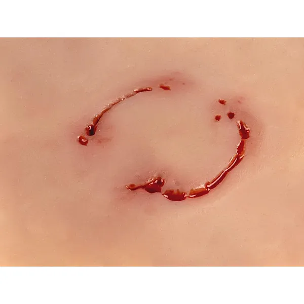 Wound Moulage "Human Bite" – Προσομοίωση Ανθρώπινου Δαγκώματος Wound Moulage "Human Bite" – Προσομοίωση Ανθρώπινου Δαγκώματος