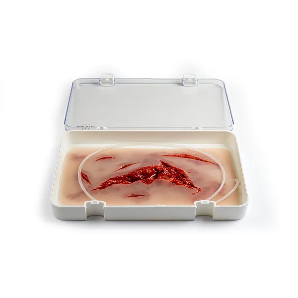Wound Moulage – Μεγάλη Ρήξη Δέρματος με Λειτουργία Αιμορραγίας