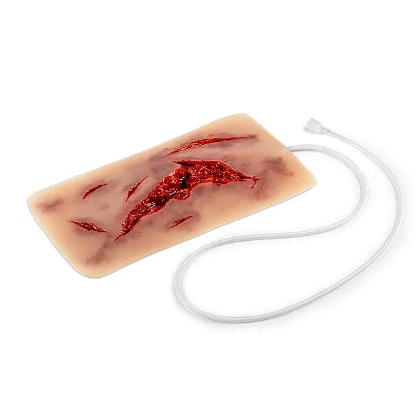 Wound Moulage – Μεγάλη Ρήξη Δέρματος με Λειτουργία Αιμορραγίας