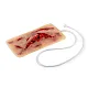 Wound Moulage – Μεγάλη Ρήξη Δέρματος με Λειτουργία Αιμορραγίας
