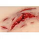 Wound Moulage – Μεγάλη Ρήξη Δέρματος με Λειτουργία Αιμορραγίας