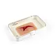 Wound Moulage "Laceration" – Προσομοίωση Ρήξης Δέρματος Wound Moulage "Laceration" – Προσομοίωση Ρήξης Δέρματος