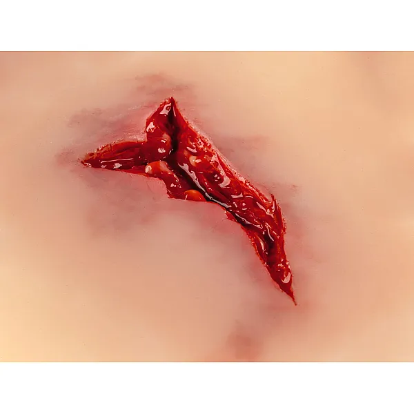 Wound Moulage "Laceration" – Προσομοίωση Ρήξης Δέρματος Wound Moulage "Laceration" – Προσομοίωση Ρήξης Δέρματος