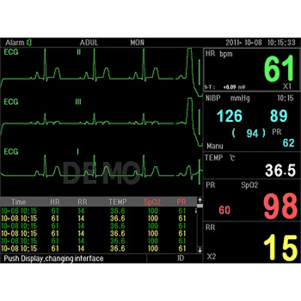 Μόνιτορ πολλαπλών παραμέτρων PC 3000 Multi Parameter Patient Monitor