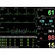 Μόνιτορ πολλαπλών παραμέτρων PC 3000 Multi Parameter Patient Monitor