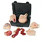 Neonatal Wound Kit – Σετ Προσομοίωσης Παθολογικών Καταστάσεων Νεογνού Neonatal Wound Kit – Σετ Προσομοίωσης Παθολογικών Καταστάσεων Νεογνού