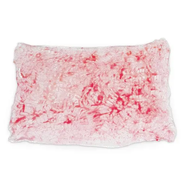 Simulated Burns – Έγκαυμα 2ου Βαθμού (Επιφανειακό) Simulated Burns – Έγκαυμα 2ου Βαθμού (Επιφανειακό)