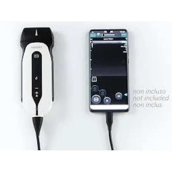 SONOEYE P2 DIGITAL COLOUR DOPPLER - Linear Array Probe SONOEYE P2 DIGITAL COLOUR DOPPLER - Linear Array Probe