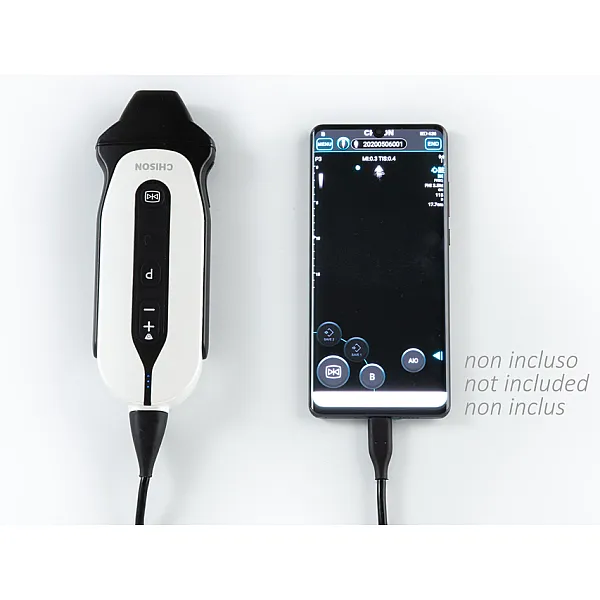 SONOEYE P3 DIGITAL COLOUR DOPPLER - Phase Array Probe SONOEYE P3 DIGITAL COLOUR DOPPLER - Phase Array Probe