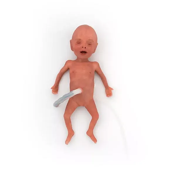 NENA Sim Preemie Xact – Προσομοιωτής Πρόωρου Νεογνού NENA Sim Preemie Xact – Προσομοιωτής Πρόωρου Νεογνού